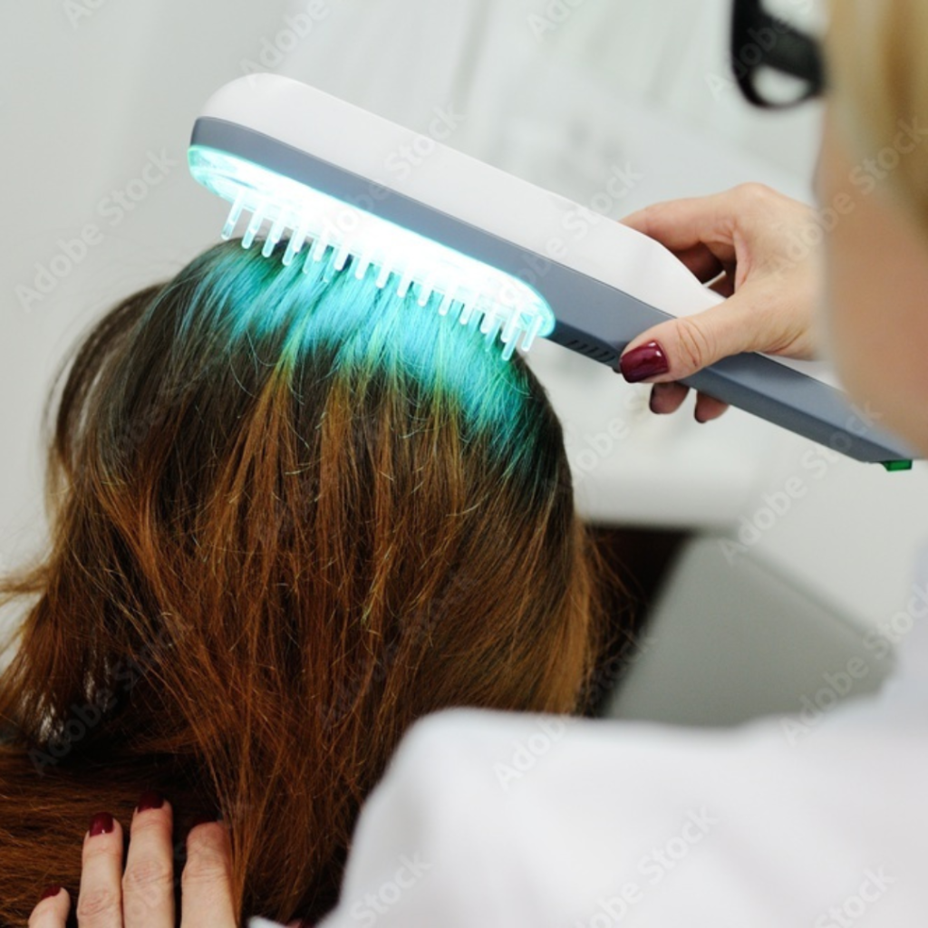 Dandruff Treatment